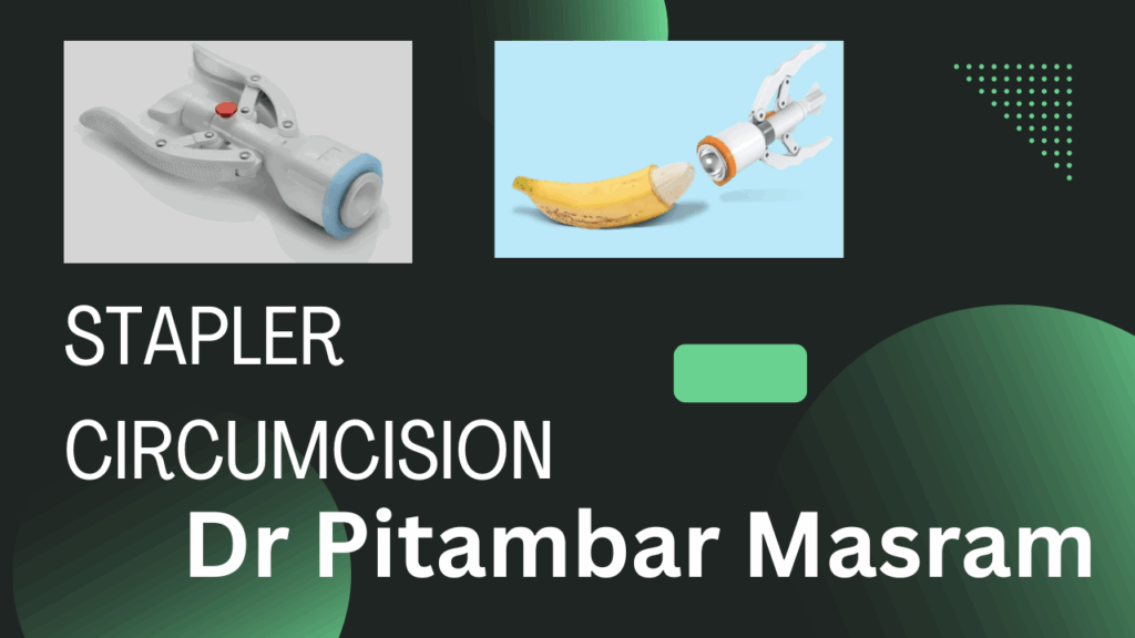 best circumcision doctor near me