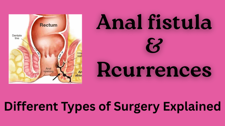 Anal Fistula Different Types Of Surgeries And Their Recurrences 