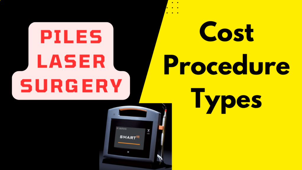 Piles Laser Treatment