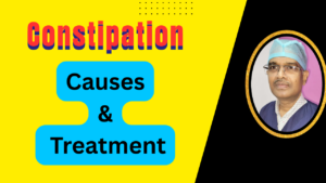 Constipation Causes and Treatment : A Simple & Practical Guide 2026